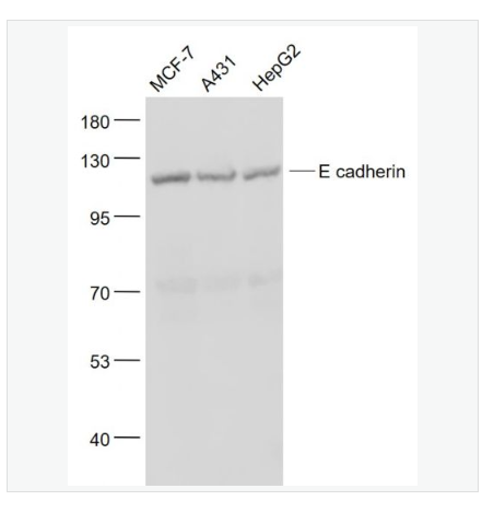 Anti-E cadherin antibody-上皮钙粘附分子抗体