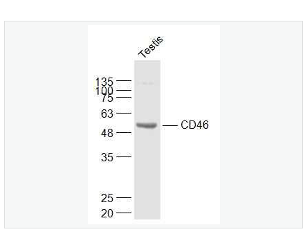 Anti-CD46 antibody-膜辅蛋白抗体