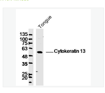 Anti-Cytokeratin 13 antibody-细胞角蛋白13抗体