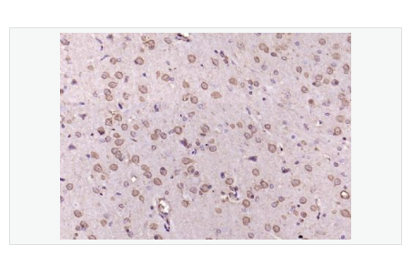 Anti-phospho-Erk1 antibody-磷酸化丝裂原活化蛋白激酶1抗体