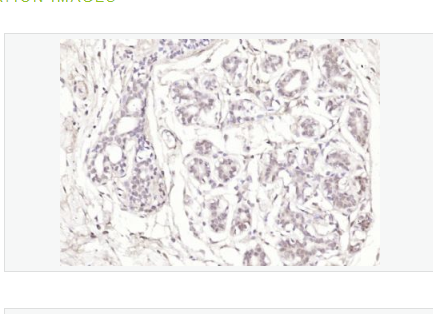 Anti-Phospho-Estrogen Receptor alpha antibody-磷磷酸化雌激素受体ER alpha 抗体