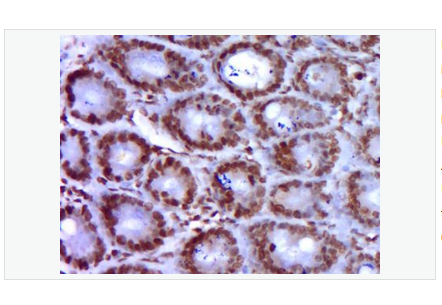 Anti-GATA5 antibody-GATA结合蛋白5抗体