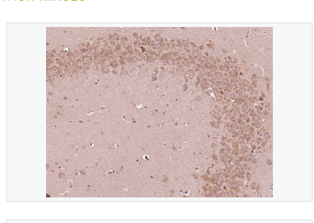 Anti-IL-6R alpha antibody-白细胞介素6受体α/IL-6Rα抗体