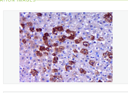 Anti-MAP1A  antibody-微管相关蛋白1A抗体