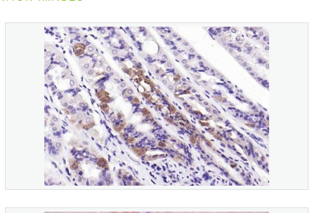 Anti-Parkin  antibody-帕金蛋白抗体