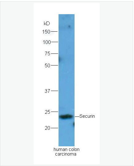 Anti-Securin antibody-垂体肿瘤转化基因抗体