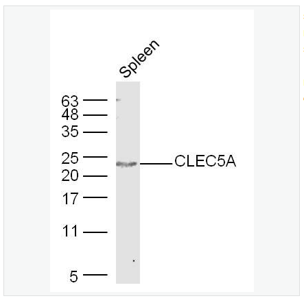 Anti-CLEC5A  antibody-C型凝集素结构域家族5成员A抗体