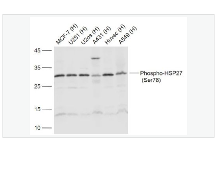 Anti-Phospho-HSP27  antibody-磷酸化热休克蛋白27抗体