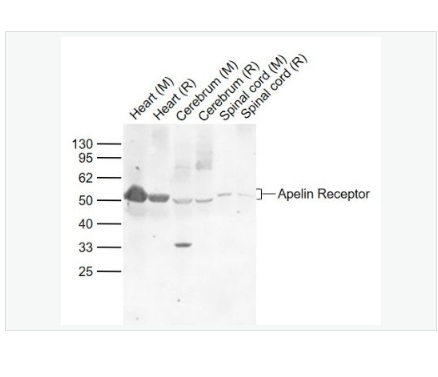 Anti-Apelin Receptor  antibody-血管紧张素II受体样蛋白1抗体