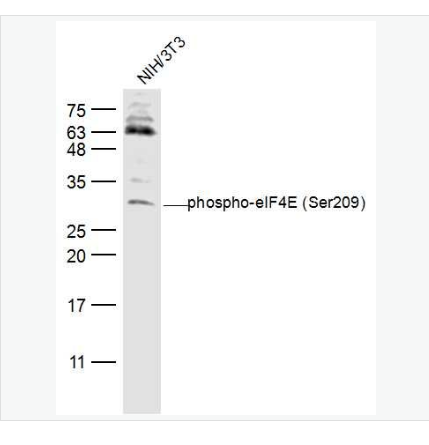 Anti-phospho-eIF4E  antibody-磷酸化真核翻译起始因子4E抗体