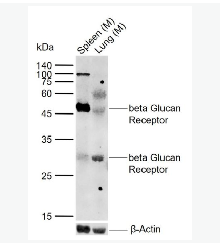 Anti-CLEC7A  antibody-β葡聚糖受体抗体
