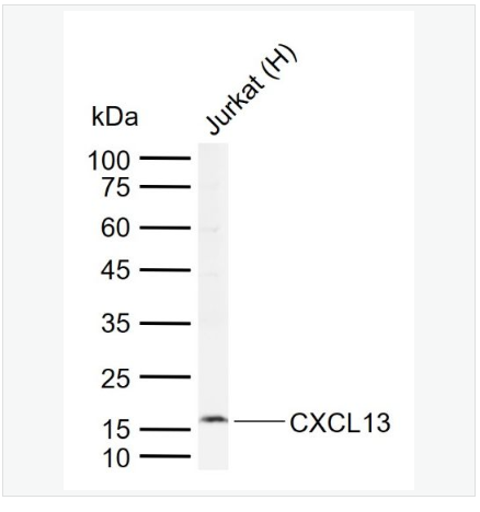 Anti-CXCL13 antibody-B-淋巴细胞趋化因子抗体