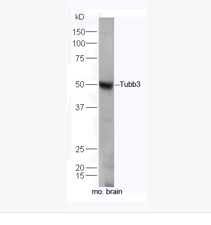 Anti-Tubb3 antibody-微管蛋白β3抗体