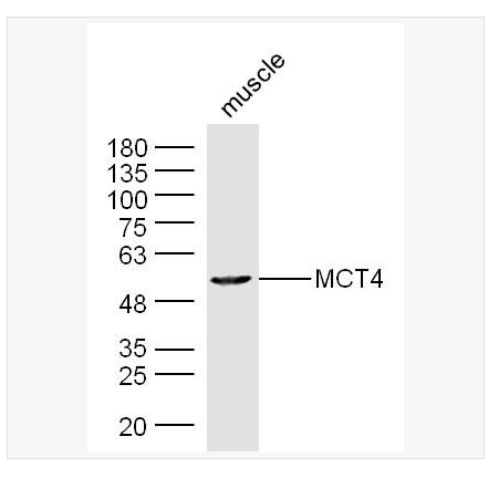 Anti-MCT4/SLC16A3 antibody-单羧酸转运蛋4抗体