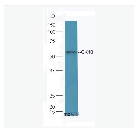 Anti-CK10 antibody-细胞角蛋白10抗体