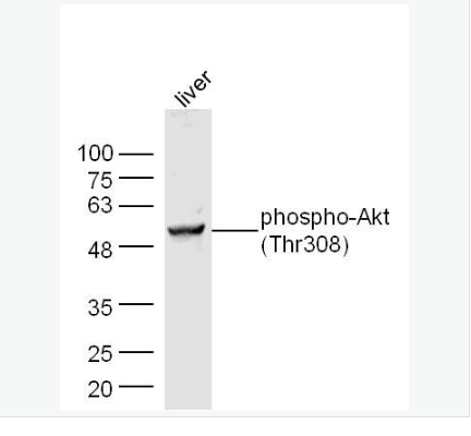 Anti-phospho-Akt antibody-磷酸化蛋白激酶B抗体