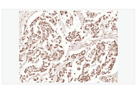 Anti-Phospho-Beta Catenin antibody-磷酸化β 连环素蛋白抗体