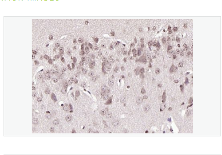 Anti-phospho-BRAF  antibody-磷酸化B-Raf抗体