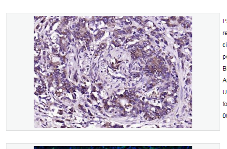 Anti-CEA  antibody-癌胚抗原抗体