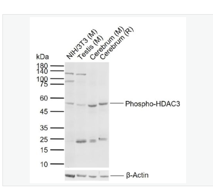 Anti-Phospho-HDAC3   antibody-磷酸化组蛋白去乙酰化酶3抗体