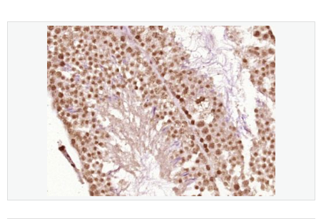 Anti-Phospho-CDK1   antibody-磷酸化周期素依赖激酶2抗体