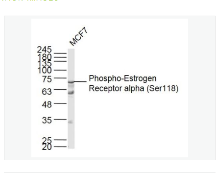 Anti-Phospho-Estrogen Receptor alpha  antibody-磷酸化雌激素受体α抗体