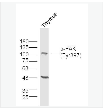 Anti-Phospho-FAK  antibody-磷酸化粘着斑激酶抗体