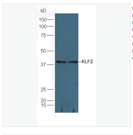 Anti-KLF2 antibody-肺Kruppel样因子抗体