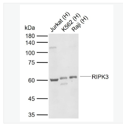 Anti-RIPK3 antibody-受体结合丝氨酸苏氨酸激酶3抗体