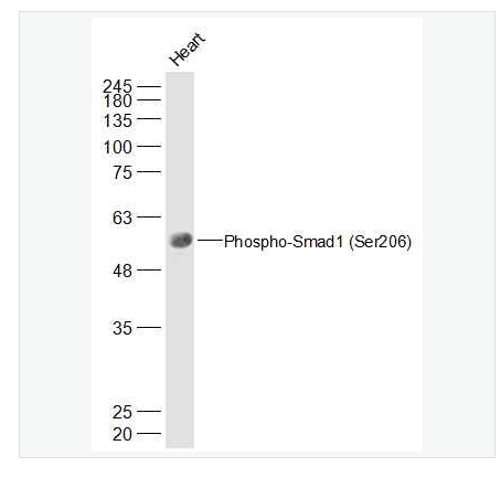 Anti-Phospho-Smad1  antibody-磷酸化细胞信号转导分子Smad-1抗体