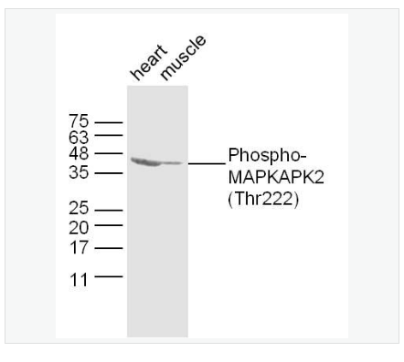 Anti-Phospho-MAPKAPK2  antibody-磷酸化丝裂原活化蛋白激酶活化的蛋白激酶2抗体