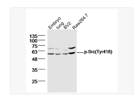 Anti-phospho-Src antibody-磷酸化Src原癌基因抗体