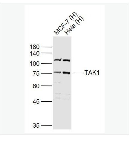 Anti-TAK1 antibody-转化生长因子β活化激酶1