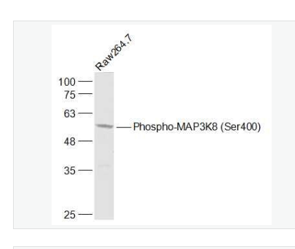 Anti-Phospho-MAP3K  antibody-磷酸化丝裂原活化蛋白激酶激酶8抗体