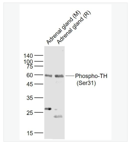 Anti-Phospho-TH  antibody-磷酸化酪氨酸羟化酶抗体