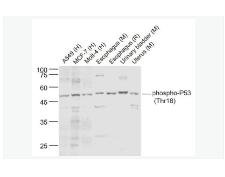 Anti-phospho-P53   antibody-磷酸化肿瘤抑制基因P53抗体