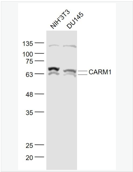 Anti-CARM1 antibody-蛋白精氨酸N甲基4抗体