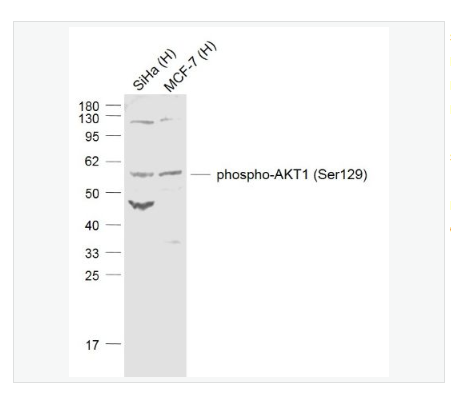 Anti-phospho-AKT1 antibody-磷酸化蛋白激酶B抗体