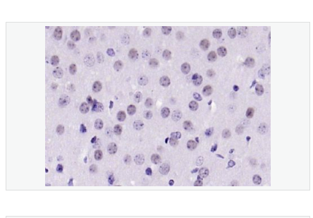 Anti-phospho-Bcl-xL antibody-磷酸化Bcl-xL蛋白抗体