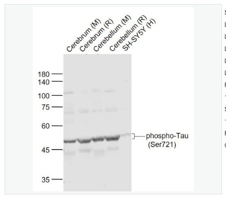 Anti-phospho-Tau antibody-磷酸化微管相关蛋白抗体