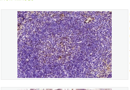 Anti-PRAK antibody-p38调节/激活蛋白激酶抗体