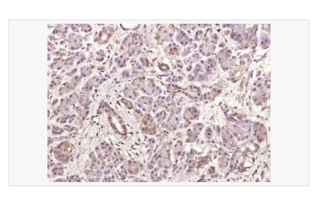 Anti-phospho-MAPKAPK5 antibody-磷酸化p38调节/激活蛋白激酶抗体