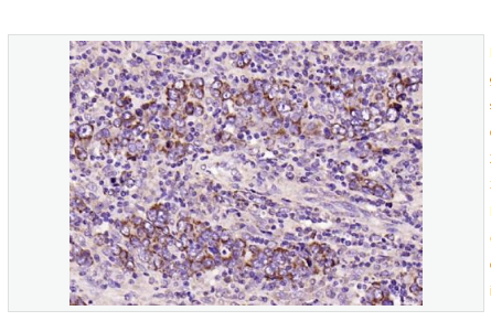 Anti-phospho-PIK3R1  antibody-磷酸化磷脂酰肌醇激酶抗体