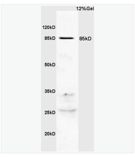 Anti-PIK3R2  antibody-磷脂酰肌醇激酶p85β抗体