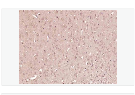 Anti-Phospho-Tuberin antibody-磷酸化结节性硬化蛋白抗体