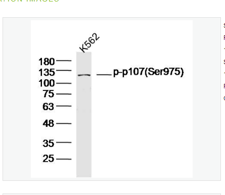 Anti-phospho-p107 antibody-磷酸化视网膜母细胞瘤样蛋白p107抗体