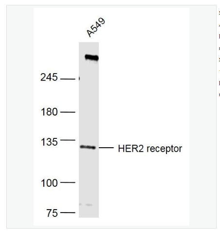 Anti-HER2 receptor  antibody-HER2受体单克隆抗体