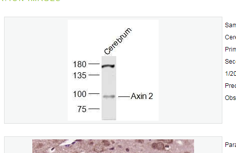 Anti-Axin 2 antibody-轴抑制蛋白2抗体