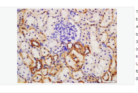 Anti-CYP2E1 antibody-细胞色素P450ⅡE1抗体