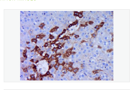 Anti-phospho-MARK2 antibody-磷酸化丝氨酸/苏氨酸蛋白激酶MARK2抗体